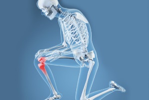 Internet-Based Rehabilitation Found to Be Effective After Knee Replacement Surgery