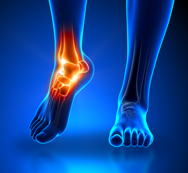 Chronic Ankle Instability: Can’t Get My Feet Under Me!