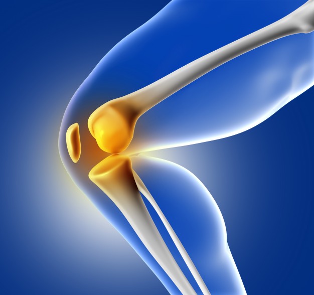 Does Physical Therapy Help Treat Knee Arthritis?