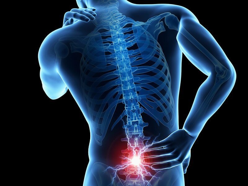 Causes of Back Pain